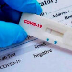 Realizan en Güines test rápidos para detectar presencia de la Covid-19