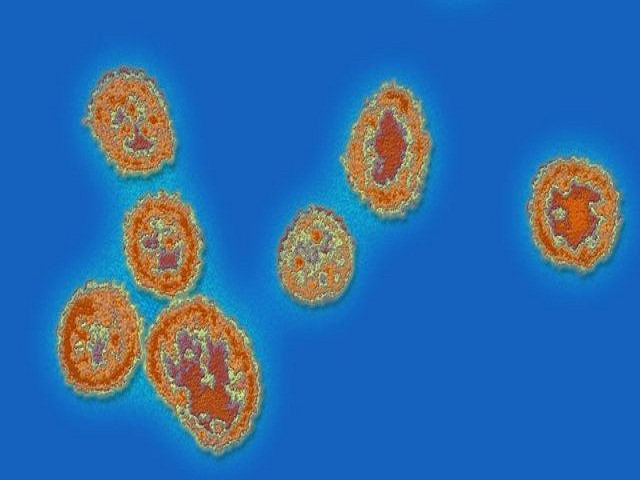 Reino Unido detecta dos casos contagiados con fiebre de Lassa.